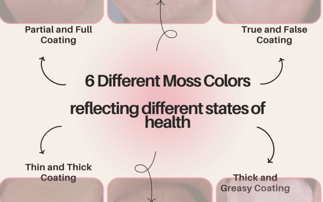 TCM Tongue Diagnosis: Unveiling the 6 Types of Health Insights Through Tongue Coating Changes