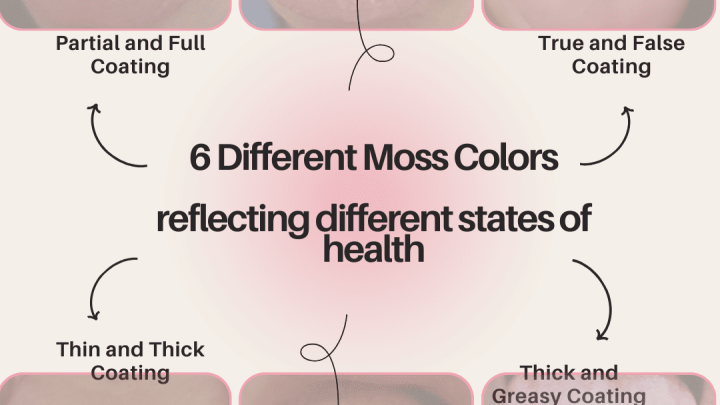 TCM Tongue Diagnosis: Unveiling the 6 Types of Health Insights Through Tongue Coating Changes