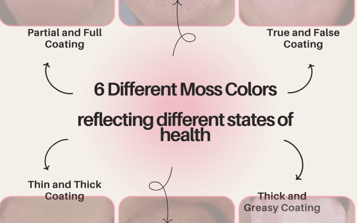 TCM Tongue Diagnosis: Unveiling the 6 Types of Health Insights Through Tongue Coating Changes