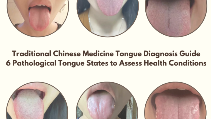 Explore Traditional Chinese Medicine Tongue Diagnosis and 6 tongue states. Learn how Tongue Shape helps assess health and detect early signs of illness