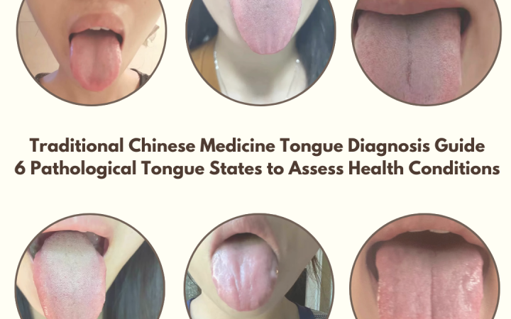 Explore Traditional Chinese Medicine Tongue Diagnosis and 6 tongue states. Learn how Tongue Shape helps assess health and detect early signs of illness