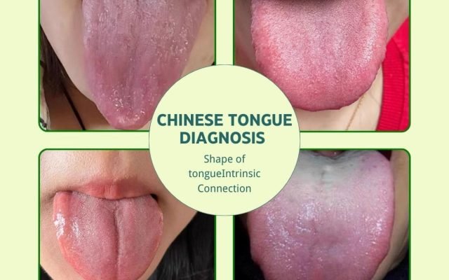 TCM Tongue DiagnosisExploring the Relationship Between Tongue Shape and Internal Organ Pathogenesis
