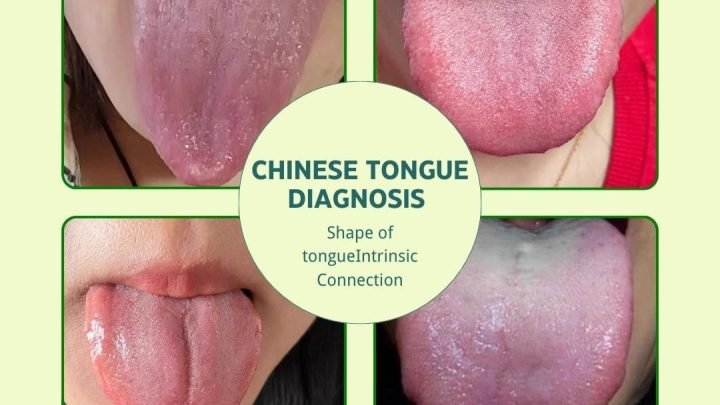 TCM Tongue DiagnosisExploring the Relationship Between Tongue Shape and Internal Organ Pathogenesis