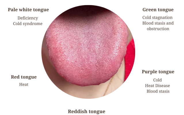 Chinese Tongue Diagnosis