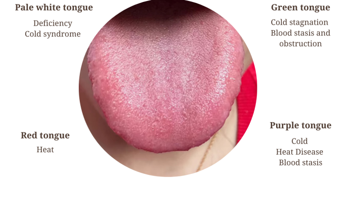 Chinese Tongue Diagnosis