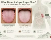 What Does a Scalloped Tongue Mean? A TCM View of Face and Tongue Signs
